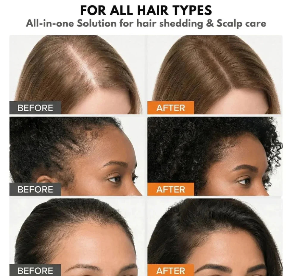 Divelic™ Korea's #1 Hair Growth Serum