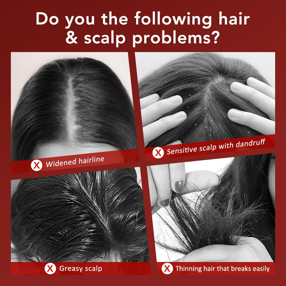 Scalp Massage Comb