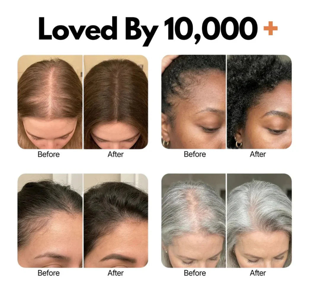 Divelic™ Korea's #1 Hair Growth Serum